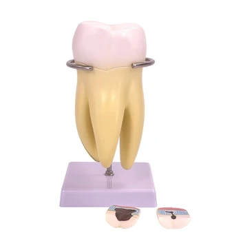 Стоматологическая модель зубов для установки в клинике и общения врача с пациентом JIAN  10